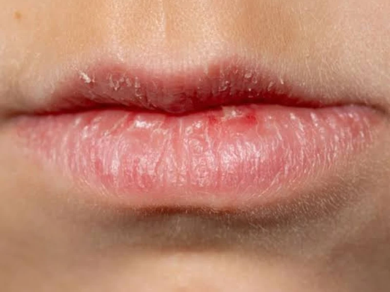 শীতের শুষ্কতায় ঠোঁট ফাটা নয়, চাই একটু যত্ন